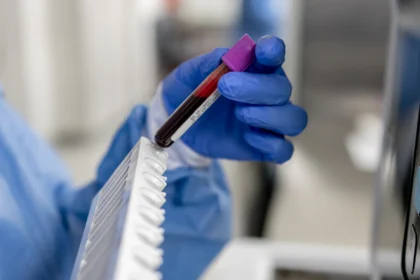 What men need to know about PSA screening for prostate cancer