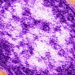 Measles: Adult woman dies amid growing Pennsylvania outbreak Measles: Adult woman dies amid growing Pennsylvania outbreak