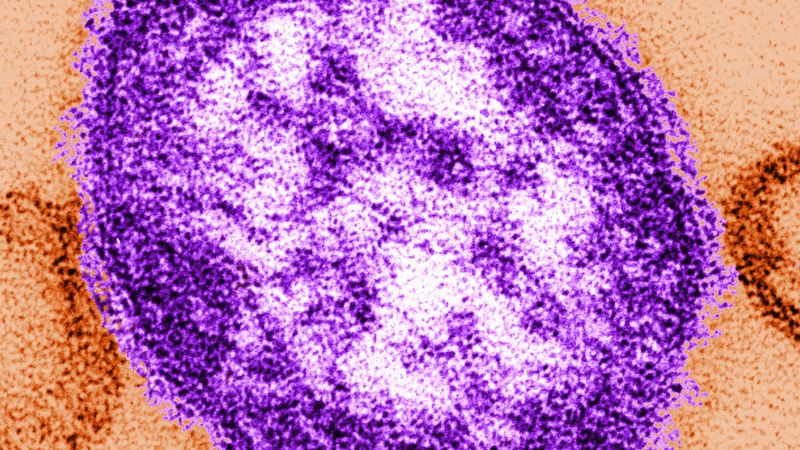 Measles: Adult woman dies amid growing Pennsylvania outbreak