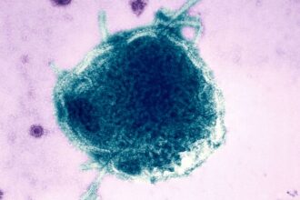 Measles: Pennsylvania reports fourth death