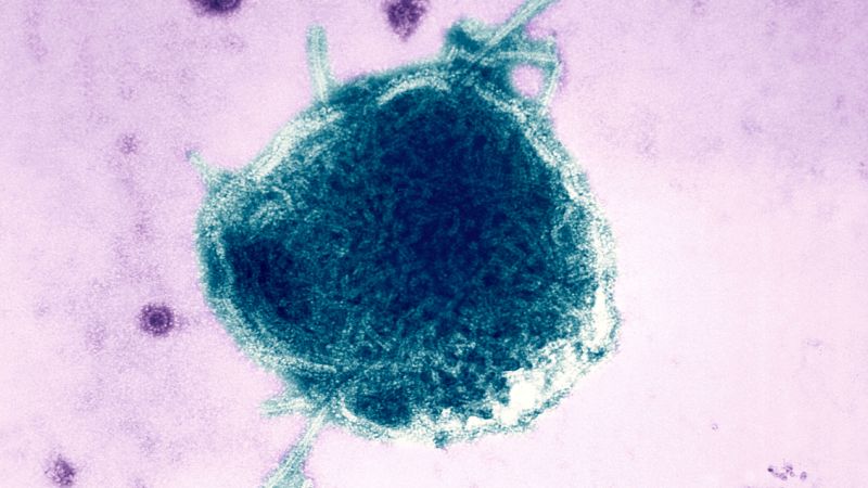 Measles: Pennsylvania reports fourth death